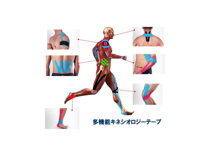 筋肉と関節をサポート◆キネシオロジーテープ