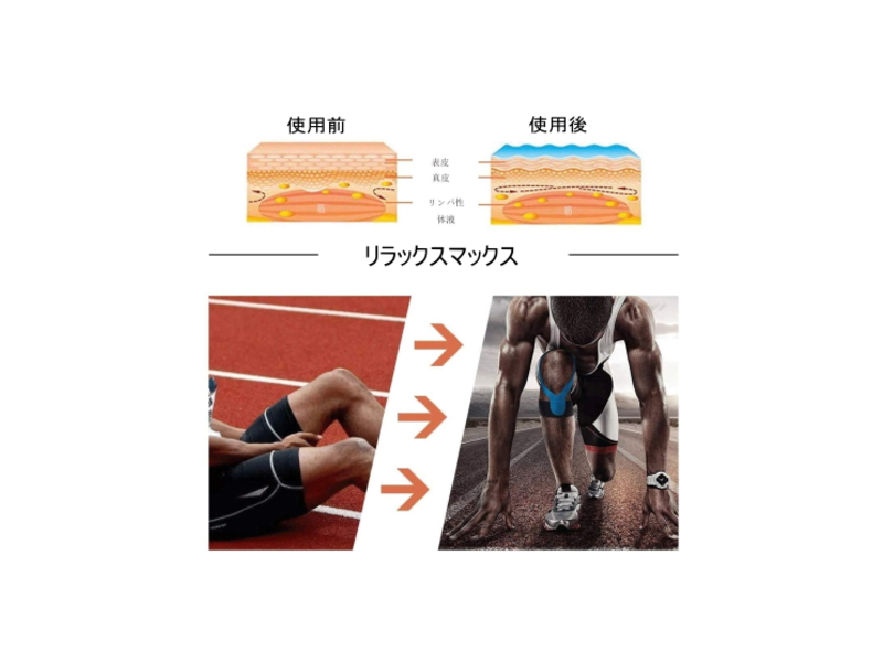 筋肉と関節をサポート◆キネシオロジーテープ